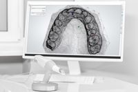 abdruckfreies Scannen und digitale Bearbeitung am 3D Bild